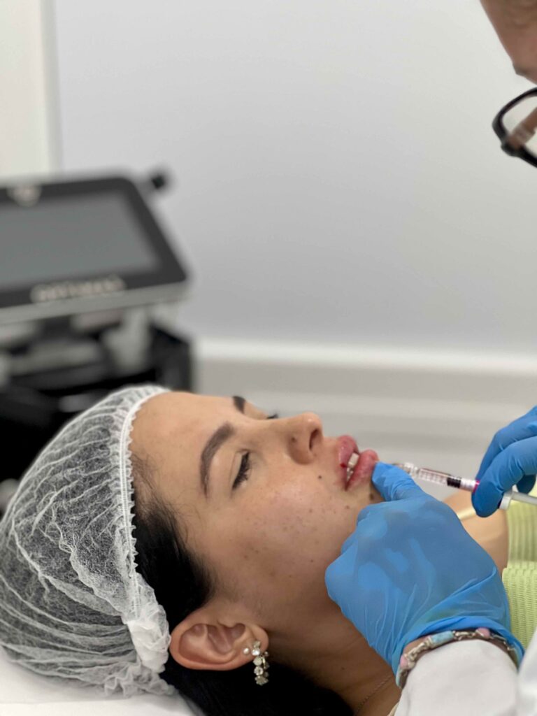 Aplicación médica de ácido hialurónico para armonización facial y rejuvenecimiento del rostro.