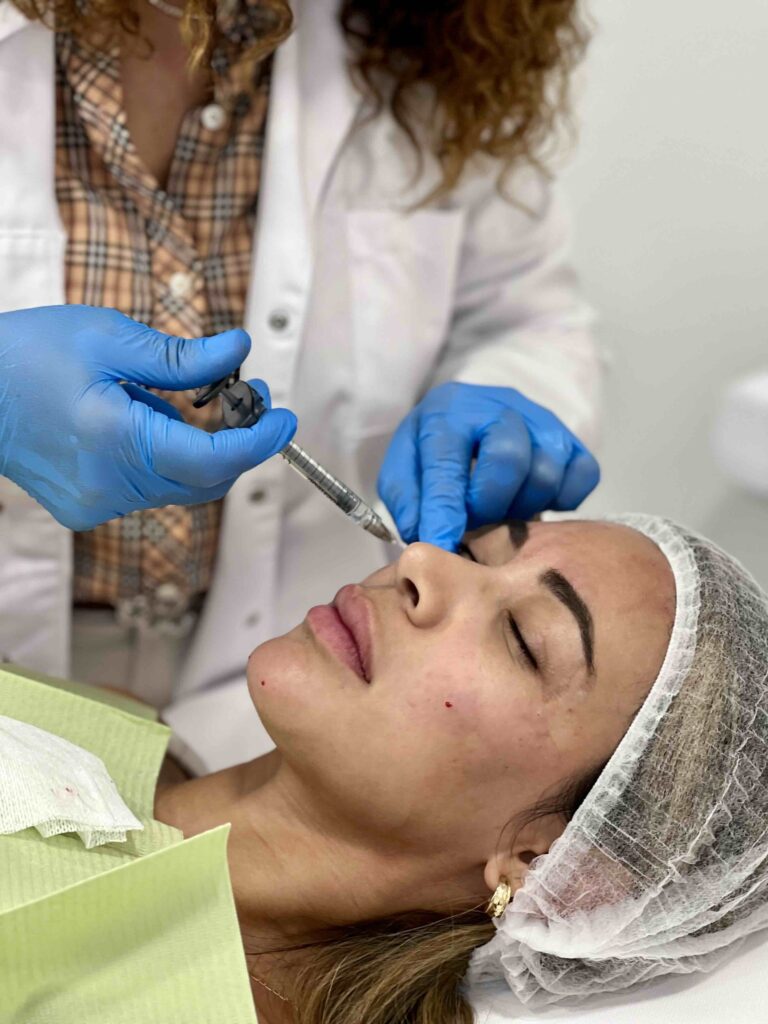 Aplicación médica de ácido hialurónico para armonización facial y rejuvenecimiento del rostro.