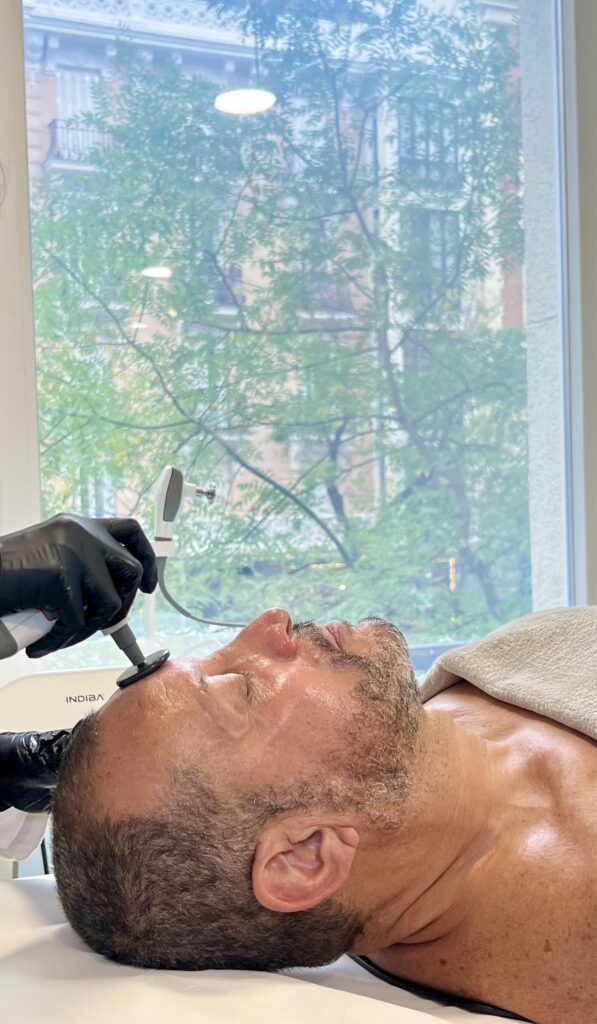 Tratamiento INDIBA facial en centro médico estético realizado al actor Fernando el Flaco Solórzano